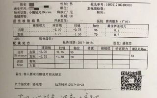 中大视光验光怎么样，中大视光验光多少钱