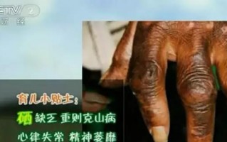 克汀病，克汀病是什么病